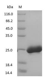 NGAL/MMP9 Complex Protein - (Tris-Glycine gel) Discontinuous SDS-PAGE (reduced) with 5% enrichment gel and 15% separation gel.