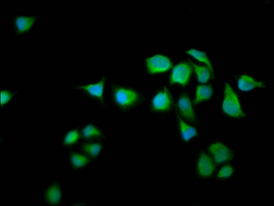 NGAP / RASAL2 Antibody - Immunofluorescence staining of Hela cells diluted at 1:66, counter-stained with DAPI. The cells were fixed in 4% formaldehyde, permeabilized using 0.2% Triton X-100 and blocked in 10% normal Goat Serum. The cells were then incubated with the antibody overnight at 4°C.The Secondary antibody was Alexa Fluor 488-congugated AffiniPure Goat Anti-Rabbit IgG (H+L).