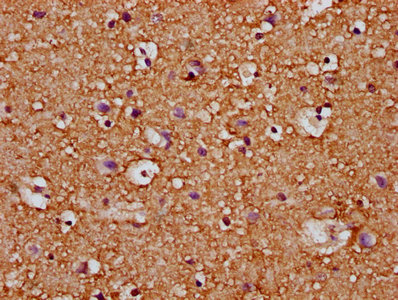 NGAP / RASAL2 Antibody - Immunohistochemistry Dilution at 1:200 and staining in paraffin-embedded human brain tissue performed on a Leica BondTM system. After dewaxing and hydration, antigen retrieval was mediated by high pressure in a citrate buffer (pH 6.0). Section was blocked with 10% normal Goat serum 30min at RT. Then primary antibody (1% BSA) was incubated at 4°C overnight. The primary is detected by a biotinylated Secondary antibody and visualized using an HRP conjugated SP system.