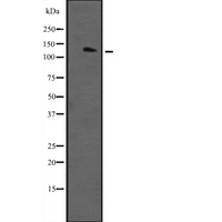 NGAP / RASAL2 Antibody - Western blot analysis of RASAL2 expression in human plasma. The lane on the left is treated with the antigen-specific peptide.