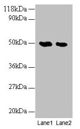 NGB / Neuroglobin Antibody - Western blot All lanes: Phosphatidylcholine-sterol acyltransferase antibody at 2µg/ml Lane 1: EC109 whole cell lysate Lane 2: 293T whole cell lysate Secondary Goat polyclonal to rabbit IgG at 1/10000 dilution Predicted band size: 48 kDa Observed band size: 48 kDa
