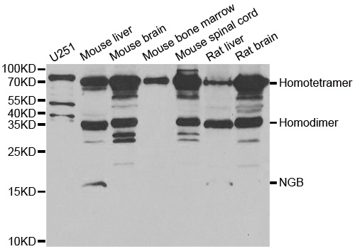 NGB / Neuroglobin Antibody - Western blot analysis of extracts of various cell lines.