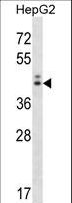 NGDN Antibody - NGDN Antibody western blot of HepG2 cell line lysates (35 ug/lane). The NGDN antibody detected the NGDN protein (arrow).