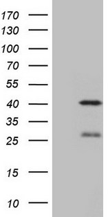 NGDN Antibody - HEK293T cells were transfected with the pCMV6-ENTRY control. (Left lane) or pCMV6-ENTRY NGDN. (Right lane) cDNA for 48 hrs and lysed. Equivalent amounts of cell lysates. (5 ug per lane) were separated by SDS-PAGE and immunoblotted with anti-NGDN. (1:2000)