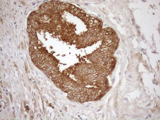 NGDN Antibody - Immunohistochemical staining of paraffin-embedded Human prostate tissue within the normal limits using anti-NGDN mouse monoclonal antibody. (Heat-induced epitope retrieval by 1mM EDTA in 10mM Tris buffer. (pH8.5) at 120°C for 3 min. (1:150)
