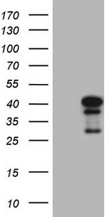 NGDN Antibody - HEK293T cells were transfected with the pCMV6-ENTRY control. (Left lane) or pCMV6-ENTRY NGDN. (Right lane) cDNA for 48 hrs and lysed. Equivalent amounts of cell lysates. (5 ug per lane) were separated by SDS-PAGE and immunoblotted with anti-NGDN. (1:2000)