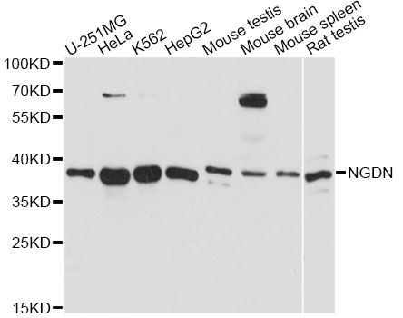 NGDN Antibody - Western blot analysis of extracts of various cell lines, using NGDN antibody at 1:3000 dilution. The secondary antibody used was an HRP Goat Anti-Rabbit IgG (H+L) at 1:10000 dilution. Lysates were loaded 25ug per lane and 3% nonfat dry milk in TBST was used for blocking. An ECL Kit was used for detection and the exposure time was 5s.