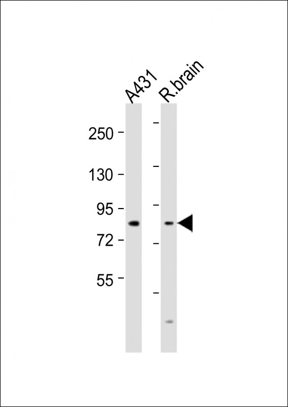 NGEF / EPHEXIN Antibody - All lanes: Anti-NGEF Antibody (N-term) at 1:1000-1:2000 dilution. Lane 1: A431 whole cell lysates. Lane 2: rat brain lysates Lysates/proteins at 20 ug per lane. Secondary Goat Anti-Rabbit IgG, (H+L), Peroxidase conjugated at 1:10000 dilution. Predicted band size: 82 kDa. Blocking/Dilution buffer: 5% NFDM/TBST.