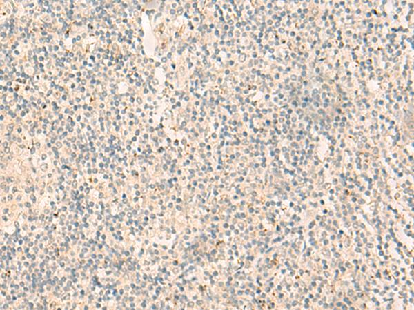 NGEF / EPHEXIN Antibody - Immunohistochemistry of paraffin-embedded Human tonsil tissue  using NGEF Polyclonal Antibody at dilution of 1:35(×200)