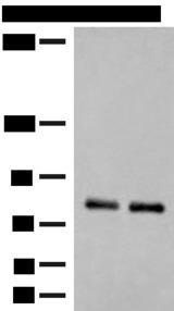 NGEF / EPHEXIN Antibody - Western blot analysis of Rat brain tissue and Mouse brain tissue lysates  using NGEF Polyclonal Antibody at dilution of 1:250