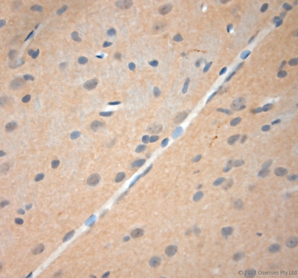 NGF Antibody - Rabbit antibody to NGF (130-180). IHC-P on paraffin sections of rat brain. The animal was perfused using Autoperfuser at a pressure of 110 mm Hg with 300 ml 4% FA and further post fixed overnight before being processed for paraffin embedding. HIER: Tris-EDTA, pH 9 for 20 min using Thermo PT Module. Blocking: 0.2% LFDM in TBST filtered through a 0.2 micron filter. Detection was done using Novolink HRP polymer from Leica following manufacturers instructions. Primary antibody: dilution 1:1000, incubated 30 min at RT using Autostainer. Sections were counterstained with Harris Hematoxylin.