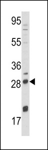 NGF Antibody - Western blot of NGFB Antibody in NCI-H460 cell line lysates (35 ug/lane). NGFB (arrow) was detected using the purified antibody.