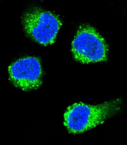 NGF Antibody - Confocal immunofluorescence of NGFB Antibody with MDA-MB231 cell followed by Alexa Fluor 488-conjugated goat anti-rabbit lgG (green). DAPI was used to stain the cell nuclear (blue).