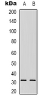 NGF Antibody - Western blot analysis of NGF beta expression in Raji (A); HepG2 (B) whole cell lysates.