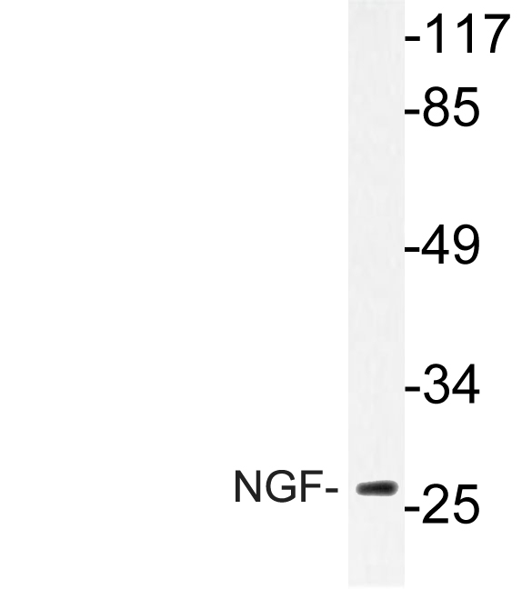 NGF Antibody - Western blot analysis of lysate from Jurkat cells, using NGF antibody.