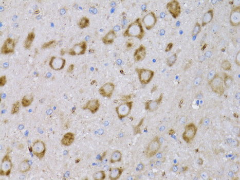 NGF Antibody - Immunohistochemistry of paraffin-embedded rat brain using NGF antibody at dilution of 1:75 (40x lens).