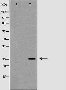 NGF Antibody - Western blot analysis of NGF beta expression in Jurkat cells. The lane on the left is treated with the antigen-specific peptide.