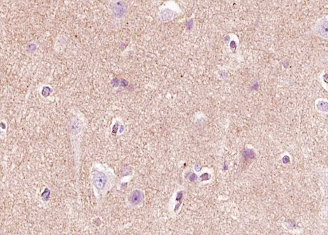 NGF Antibody - 1:100 staining human brain tissue by IHC-P. The tissue was formaldehyde fixed and a heat mediated antigen retrieval step in citrate buffer was performed. The tissue was then blocked and incubated with the antibody for 1.5 hours at 22°C. An HRP conjugated goat anti-rabbit antibody was used as the secondary.