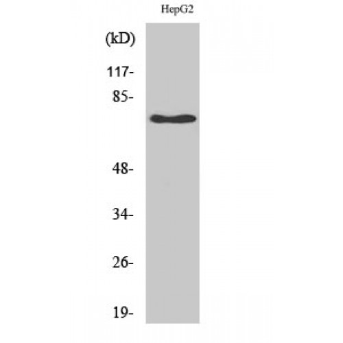 NGFR / CD271 / TNR16 Antibody - Western blot of NGFR p75 antibody