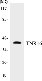 NGFR / CD271 / TNR16 Antibody - Western blot analysis of the lysates from HeLa cells using TNR16 antibody.