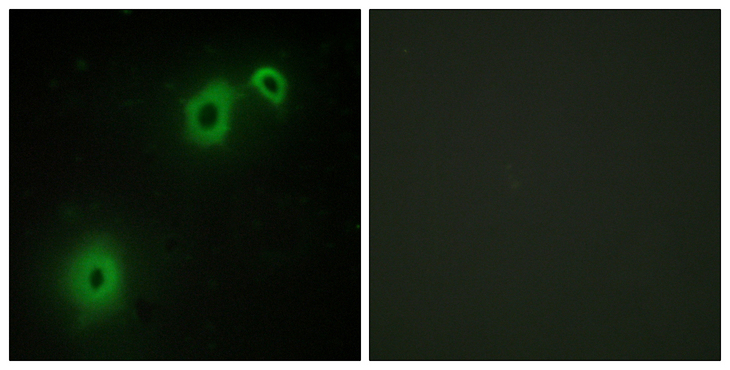 NGFR / CD271 / TNR16 Antibody - Immunofluorescence analysis of A549 cells, using TNR16 Antibody. The picture on the right is blocked with the synthesized peptide.