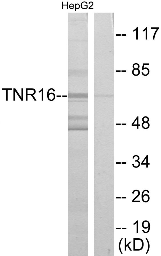 NGFR / CD271 / TNR16 Antibody - Western blot analysis of lysates from HepG2 cells, using TNR16 Antibody. The lane on the right is blocked with the synthesized peptide.