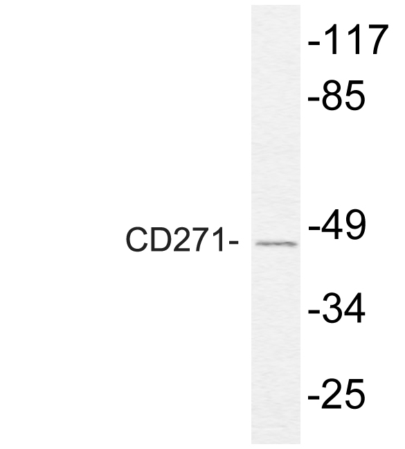 NGFR / CD271 / TNR16 Antibody - Western blot analysis of lysate from HeLa cells, uisng CD271 antibody.