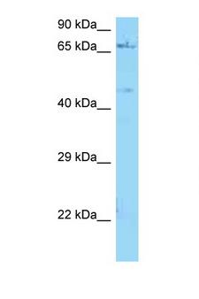 NGFR / CD271 / TNR16 Antibody - NGFR antibody Western blot of ACHN Cell lysate. Antibody concentration 1 ug/ml.  This image was taken for the unconjugated form of this product. Other forms have not been tested.
