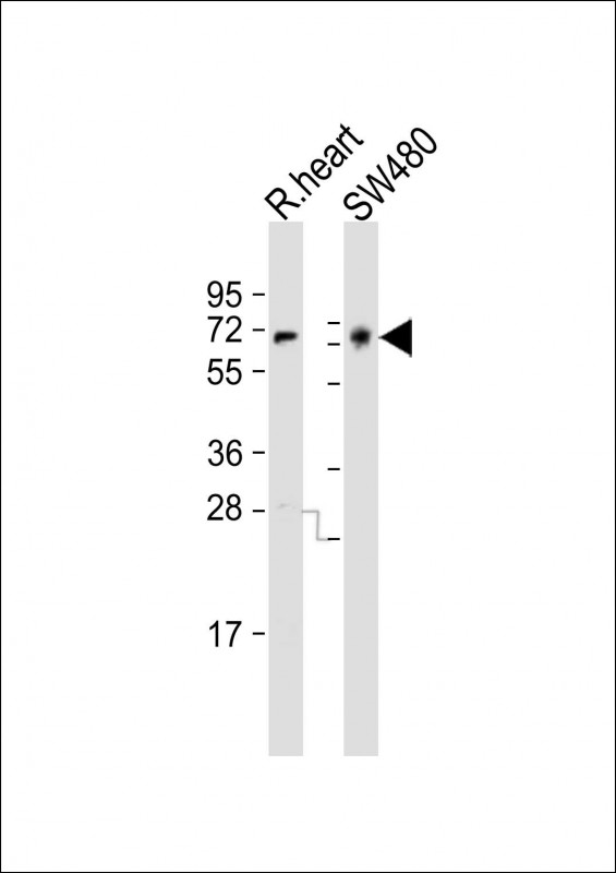 NGFR / CD271 / TNR16 Antibody - All lanes: Anti-NGFR Antibody (C-term) at1:1000-1:2000 dilution. Lane 1: rat heart lysate. Lane 2: SW480 whole cell lysate Lysates/proteins at 20 ug per lane. Secondary Goat Anti-Rabbit IgG, (H+L), Peroxidase conjugated at 1:10000 dilution. Predicted band size: 45 kDa. Blocking/Dilution buffer: 5% NFDM/TBST.