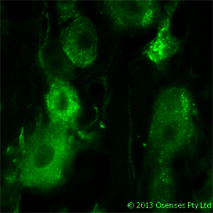 NGFR / CD271 / TNR16 Antibody - Mouse monoclonal antibody to rat p75NTR (MC192). IF on rat trigeminal using Mouse monoclonal antibody to rat p75NTR at a concentration of 10 ug/ml.
