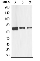 NGFR / CD271 / TNR16 Antibody - Western blot analysis of CD271 expression in HEK293 (A); Raw264.7 (B); PC12 (C) whole cell lysates.