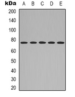 NGFR / CD271 / TNR16 Antibody - Western blot analysis of CD271 expression in HeLa (A); L929 (B); mouse brain (C); rat muscle (D); rat kidney (E) whole cell lysates.