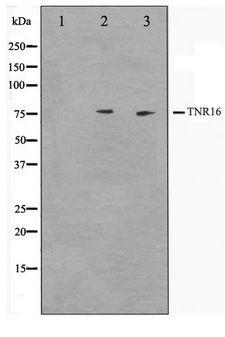 NGFR / CD271 / TNR16 Antibody - Western blot of Jurkat and NIH-3T3 cell lysate using CD271 Antibody