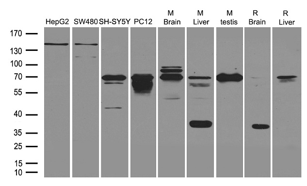 NGFR / CD271 / TNR16 Antibody - Western blot analysis of extracts. (35ug) from different cell lines or tissues by using anti-NGFR rabbit polyclonal antibody .