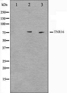 NGFR / CD271 / TNR16 Antibody - Western blot analysis on Jurkat and NIH-3T3 cell lysates using CD271 antibody. The lane on the left is treated with the antigen-specific peptide.