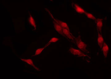 NGFR / CD271 / TNR16 Antibody