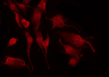 NGFR / CD271 / TNR16 Antibody - Staining HepG2 cells by IF/ICC. The samples were fixed with PFA and permeabilized in 0.1% Triton X-100, then blocked in 10% serum for 45 min at 25°C. The primary antibody was diluted at 1:200 and incubated with the sample for 1 hour at 37°C. An Alexa Fluor 594 conjugated goat anti-rabbit IgG (H+L) Ab, diluted at 1/600, was used as the secondary antibody.