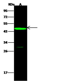 NGFR / CD271 / TNR16 Antibody - Anti-NGFR rabbit polyclonal antibody at 1:500 dilution. Lane A: ACHN Whole Cell Lysate. Lysates/proteins at 30 ug per lane. Secondary: Goat Anti-Rabbit IgG H&L (Dylight 800) at 1/10000 dilution. Developed using the Odyssey technique. Performed under reducing conditions. Predicted band size: 45 kDa. Observed band size: 45 kDa. (We are unsure as to the identity of these extra bands.)