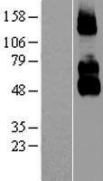 NGFR / CD271 / TNR16 Protein - Western validation with an anti-DDK antibody * L: Control HEK293 lysate R: Over-expression lysate