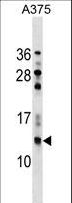 NGFRAP1 / NADE / Bex Antibody - NGFRAP1 Antibody western blot of A375 cell line lysates (35 ug/lane). The NGFRAP1 antibody detected the NGFRAP1 protein (arrow).