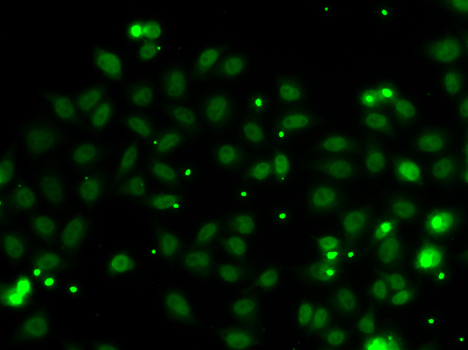 NGFRAP1 / NADE / Bex Antibody - Immunofluorescence analysis of MCF7 cells.