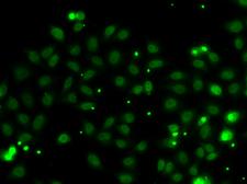 NGFRAP1 / NADE / Bex Antibody - Immunofluorescence analysis of MCF7 cells.