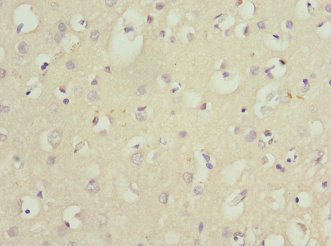 NGFRAP1 / NADE / Bex Antibody - Immunohistochemistry of paraffin-embedded human brain tissue at dilution 1:100