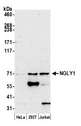NGLY1 Antibody - Detection of human NGLY1 by western blot. Samples: Whole cell lysate (15 µg) from HeLa, HEK293T, and Jurkat cells prepared using NETN lysis buffer. Antibody: Affinity purified rabbit anti-NGLY1 antibody used for WB at 0.1 µg/ml. Detection: Chemiluminescence with an exposure time of 3 minutes.