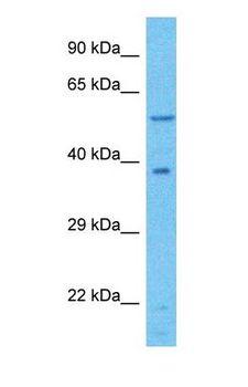 NGLY1 Antibody - Western blot of NGLY1 Antibody with human 786-0 Whole Cell lysate.  This image was taken for the unconjugated form of this product. Other forms have not been tested.