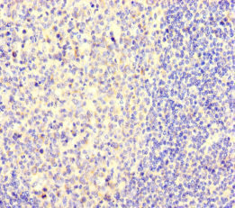 NGN / Neogenin Antibody - Immunohistochemistry of paraffin-embedded human tonsil tissue at dilution of 1:100