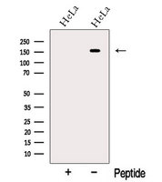NGN / Neogenin Antibody - Western blot analysis of extracts of HeLa cells using Neogenin-Specific antibody. The lane on the left was treated with blocking peptide.