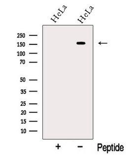 NGN / Neogenin Antibody - Western blot analysis of extracts of HeLa cells using Neogenin-Specific antibody. The lane on the left was treated with blocking peptide.
