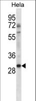 NHEJ1 / XLF Antibody - NHEJ1 Antibody western blot of HeLa cell line lysates (35 ug/lane). The NHEJ1 antibody detected the NHEJ1 protein (arrow).