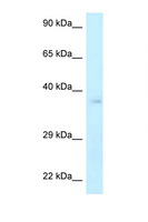 NHEJ1 / XLF Antibody - NHEJ1 antibody Western blot of ACHN Cell lysate. Antibody concentration 1 ug/ml.  This image was taken for the unconjugated form of this product. Other forms have not been tested.